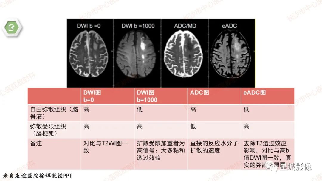 影像PPT - 【PPT】DWI序列判读原则及临床应用-22