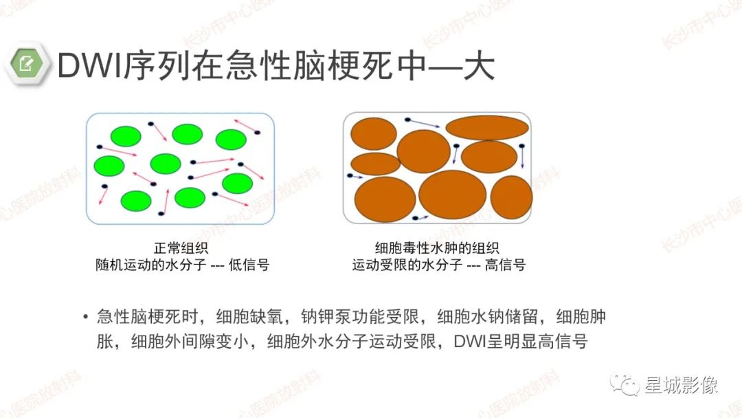 影像PPT - 【PPT】DWI序列判读原则及临床应用-24
