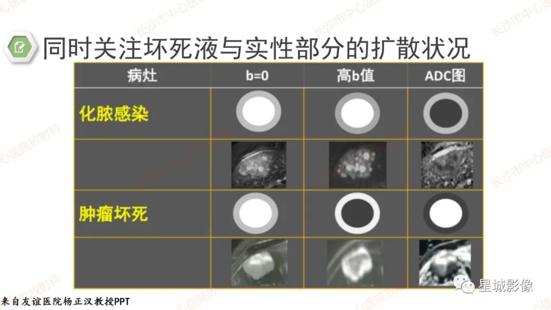 影像PPT - 【PPT】DWI序列判读原则及临床应用-34