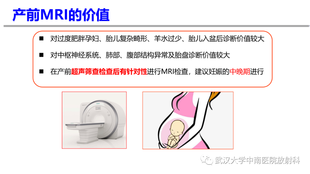 影像PPT - 【PPT】前置胎盘及胎盘植入磁共振成像-3
