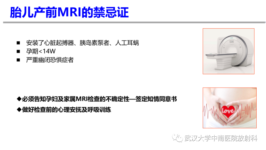 影像PPT - 【PPT】前置胎盘及胎盘植入磁共振成像-5