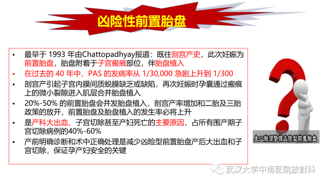影像PPT - 【PPT】前置胎盘及胎盘植入磁共振成像-15