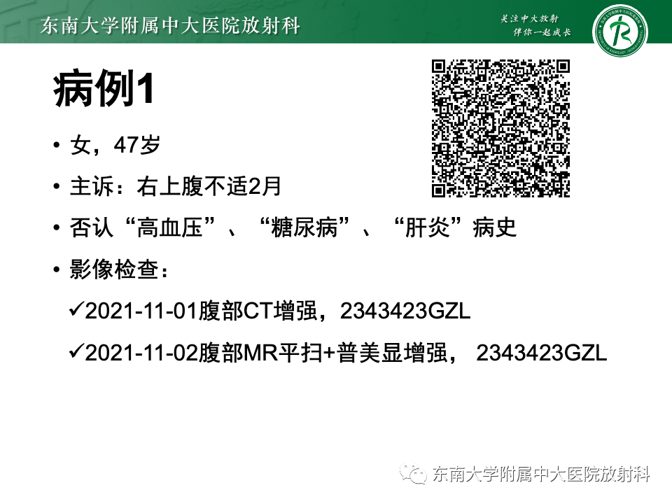 影像PPT - 【PPT】肝细胞腺瘤-3