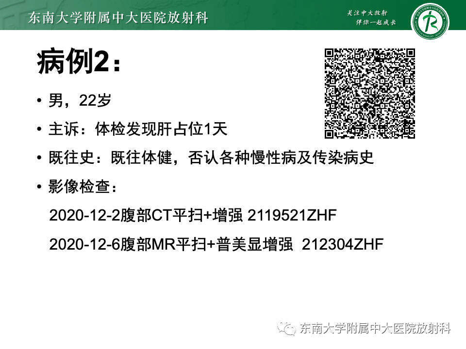影像PPT - 【PPT】肝细胞腺瘤-21