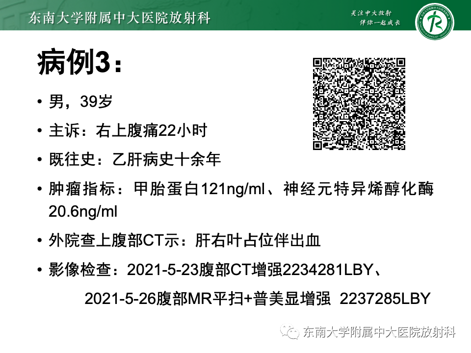 影像PPT - 【PPT】肝细胞腺瘤-28