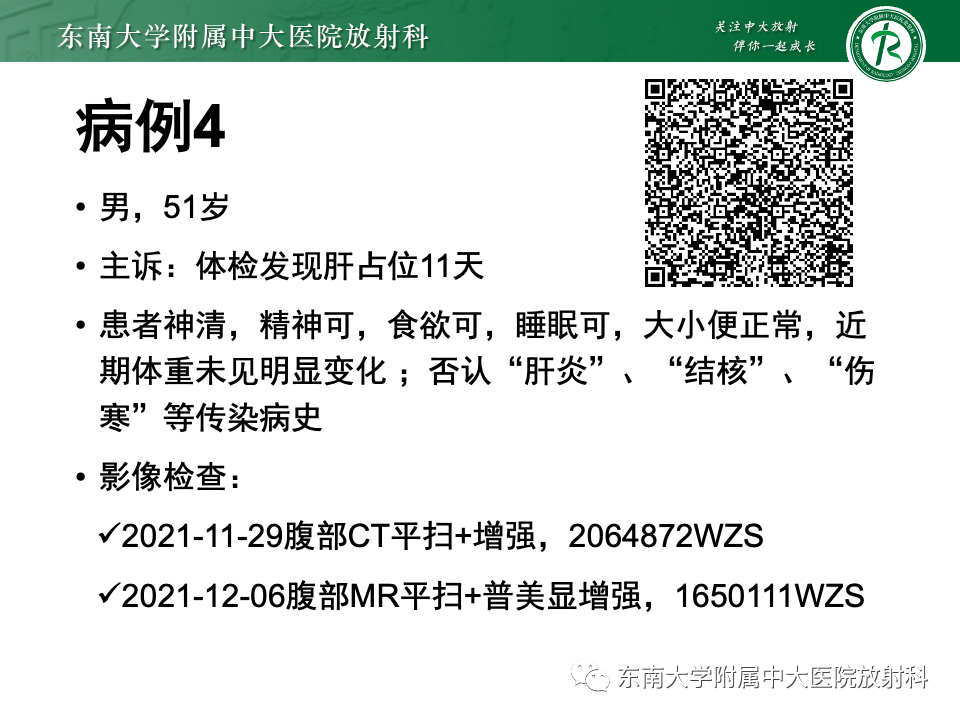 影像PPT - 【PPT】肝细胞腺瘤-11