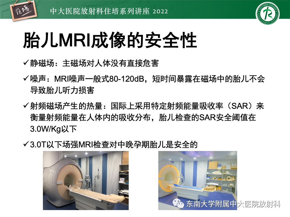 影像PPT - 【PPT】胎儿颅脑MRI技术及常见神经系统发育异常-10