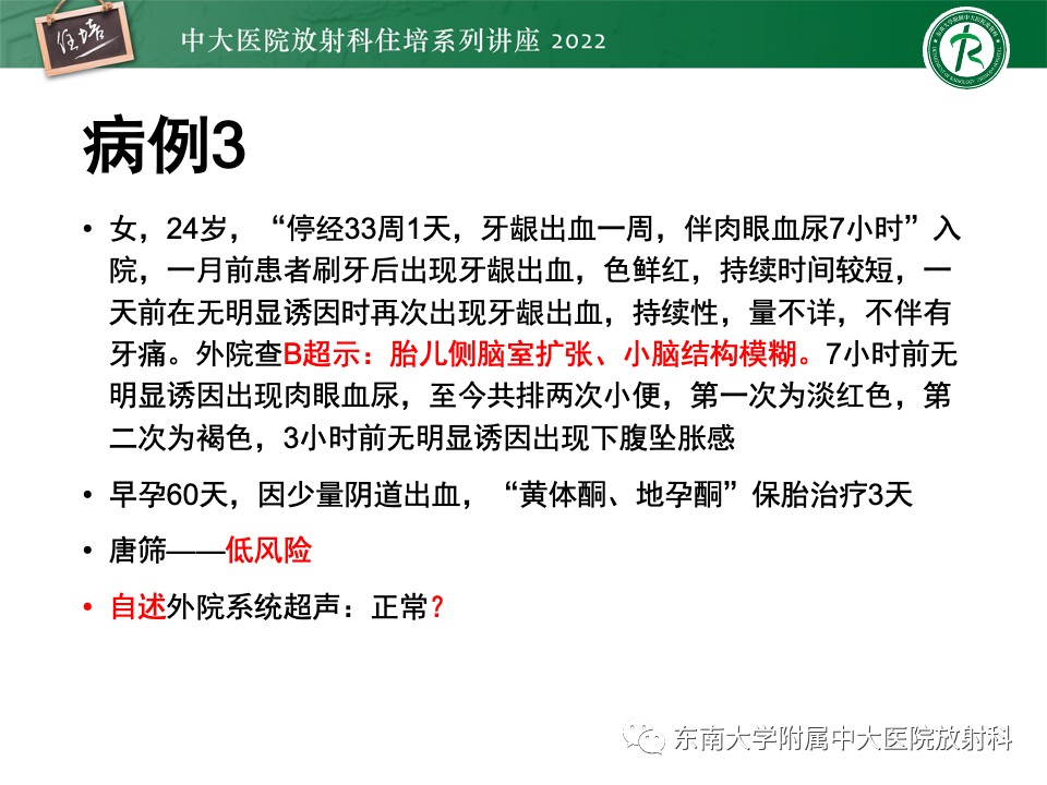 影像PPT - 【PPT】胎儿颅脑MRI技术及常见神经系统发育异常-4