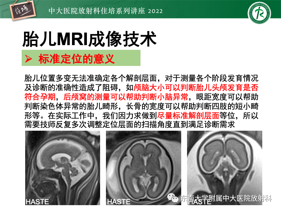 影像PPT - 【PPT】胎儿颅脑MRI技术及常见神经系统发育异常-9
