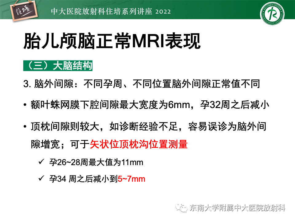 影像PPT - 【PPT】胎儿颅脑MRI技术及常见神经系统发育异常-17