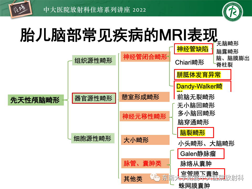 影像PPT - 【PPT】胎儿颅脑MRI技术及常见神经系统发育异常-25