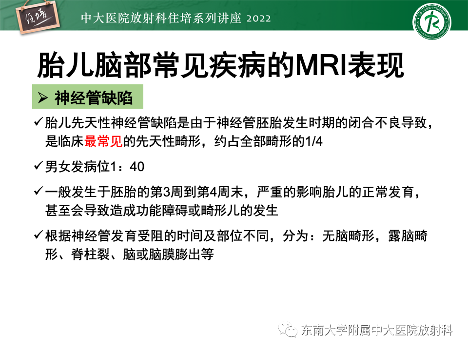 影像PPT - 【PPT】胎儿颅脑MRI技术及常见神经系统发育异常-26