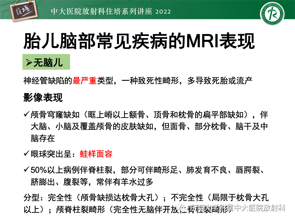 影像PPT - 【PPT】胎儿颅脑MRI技术及常见神经系统发育异常-27