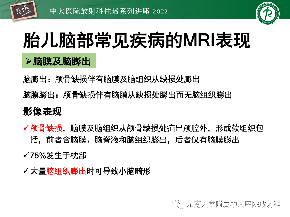 影像PPT - 【PPT】胎儿颅脑MRI技术及常见神经系统发育异常-29