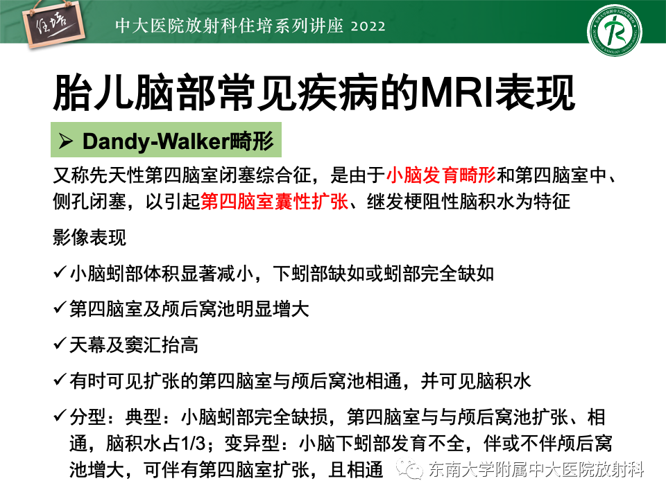 影像PPT - 【PPT】胎儿颅脑MRI技术及常见神经系统发育异常-31