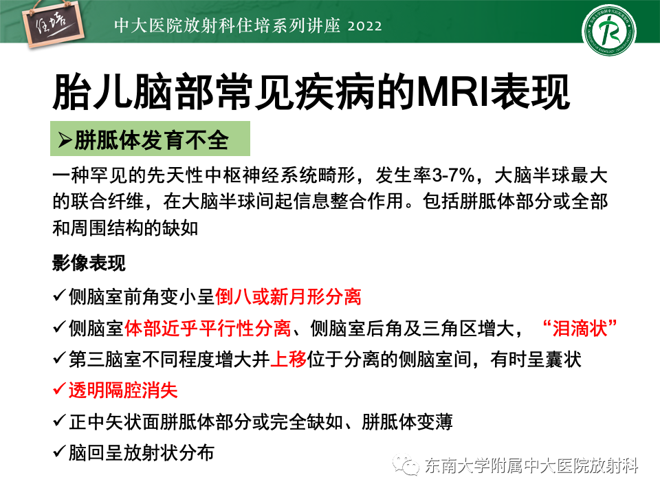 影像PPT - 【PPT】胎儿颅脑MRI技术及常见神经系统发育异常-33