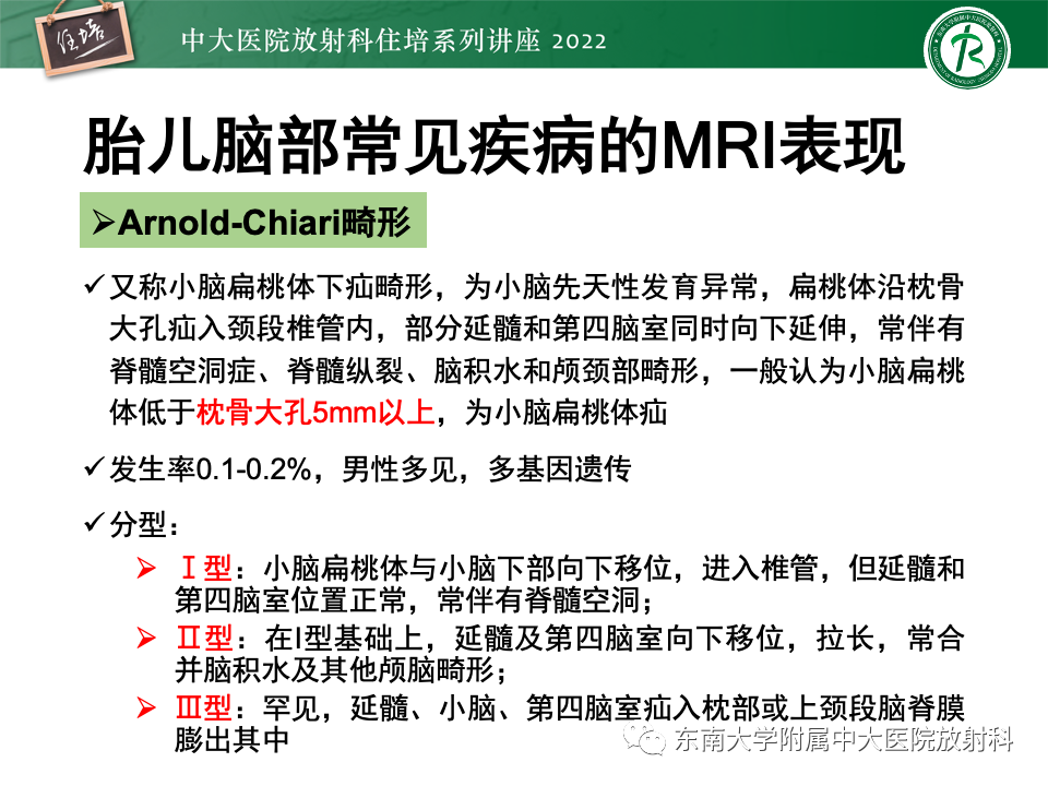 影像PPT - 【PPT】胎儿颅脑MRI技术及常见神经系统发育异常-36