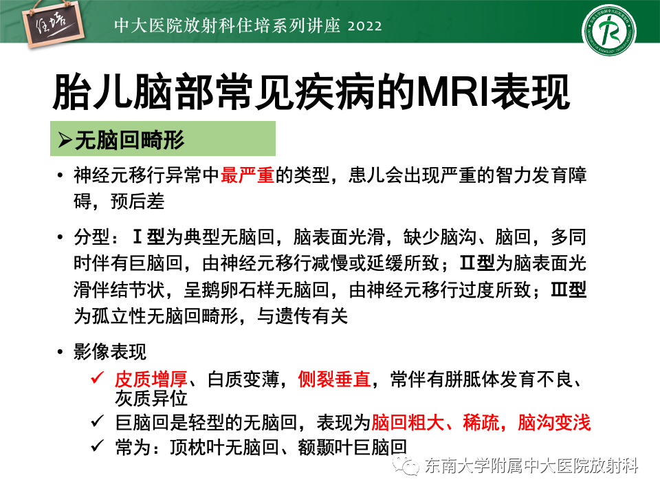 影像PPT - 【PPT】胎儿颅脑MRI技术及常见神经系统发育异常-39