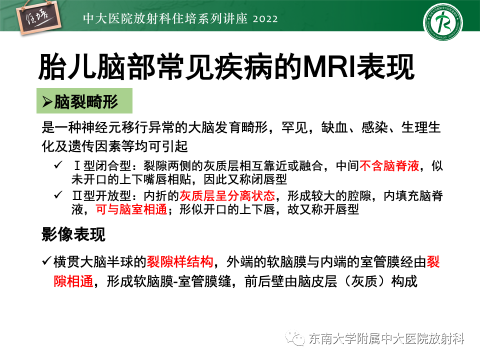 影像PPT - 【PPT】胎儿颅脑MRI技术及常见神经系统发育异常-41