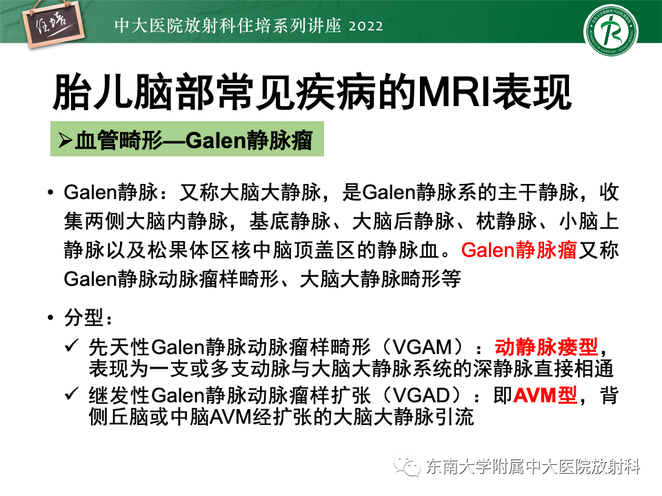 影像PPT - 【PPT】胎儿颅脑MRI技术及常见神经系统发育异常-43