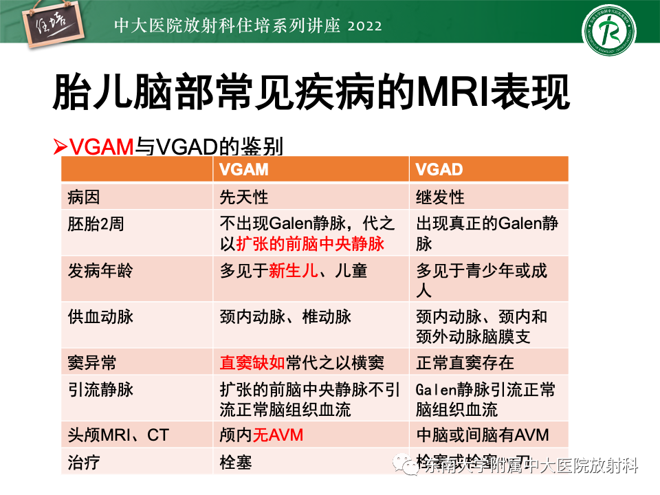 影像PPT - 【PPT】胎儿颅脑MRI技术及常见神经系统发育异常-44