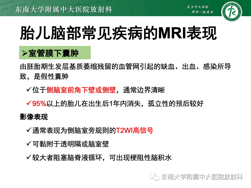 影像PPT - 【PPT】胎儿颅脑MRI技术及常见神经系统发育异常-48