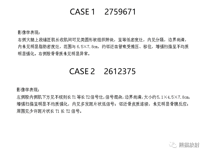 影像PPT - 【病例】软组织血管纤维瘤2例CT及MR影像-25