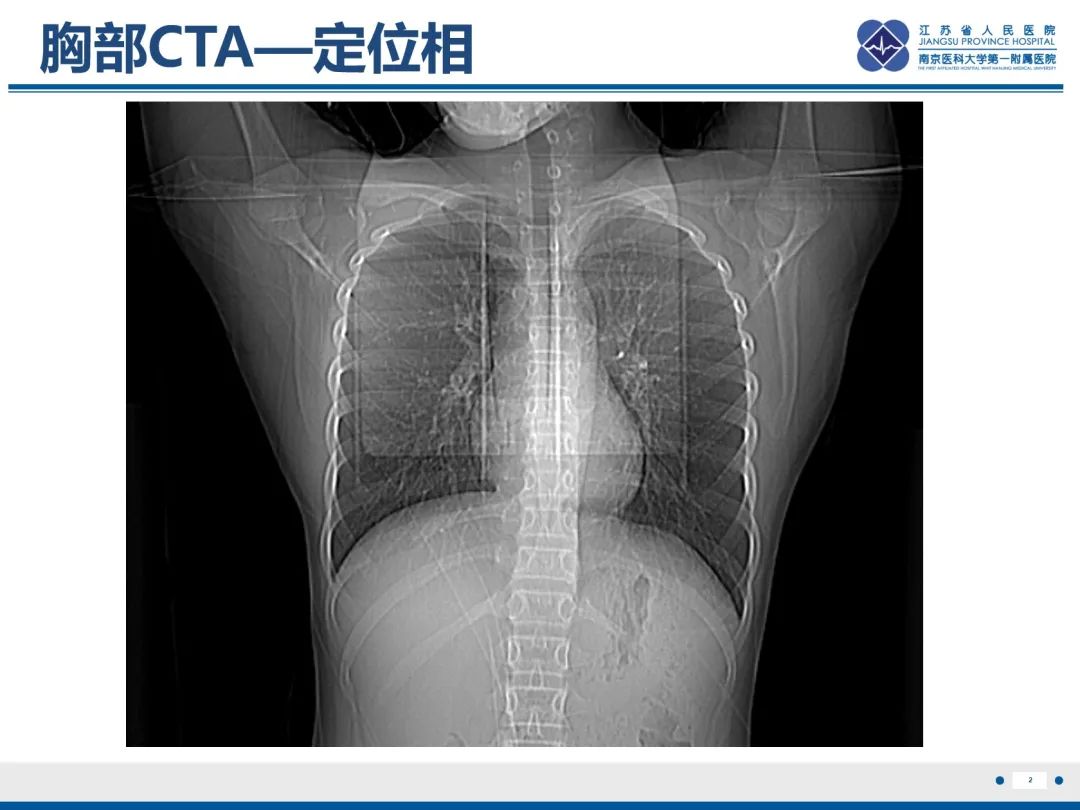 影像PPT - 【PPT】胸廓出口综合征-3
