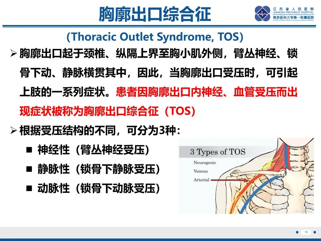 影像PPT - 【PPT】胸廓出口综合征-16