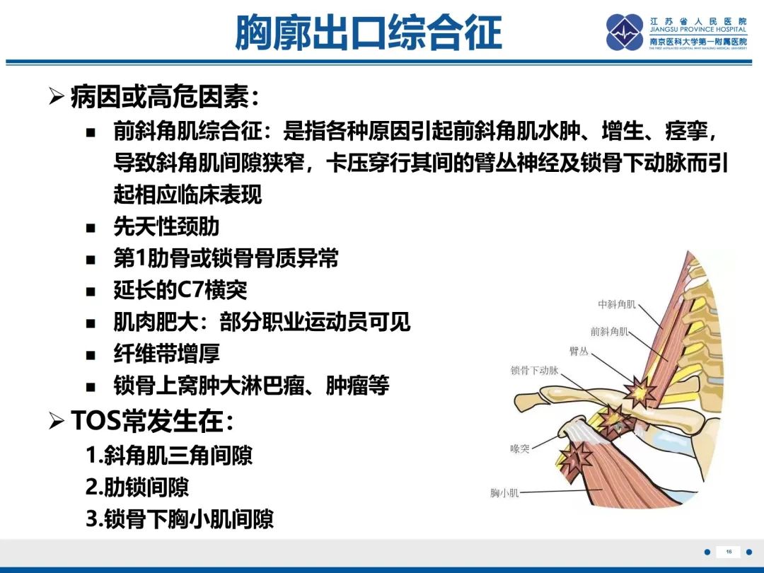 影像PPT - 【PPT】胸廓出口综合征-17
