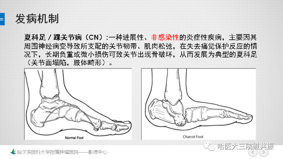 影像PPT - 【PPT】夏科足-6