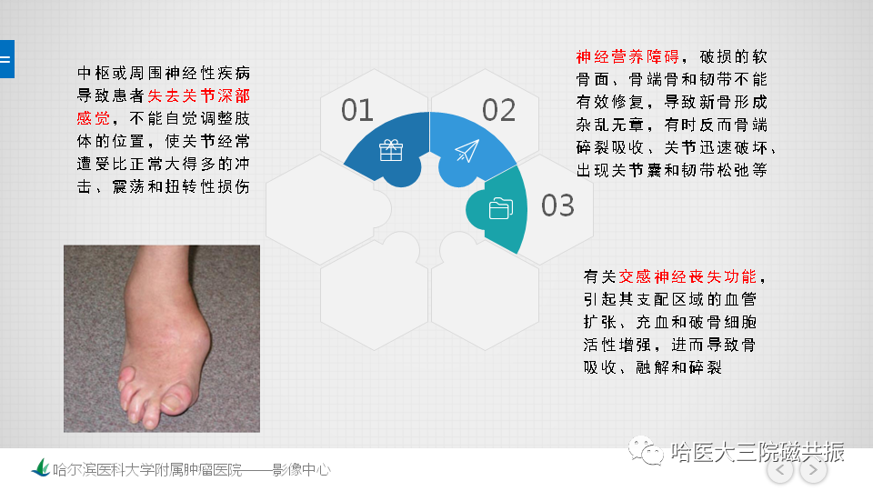 影像PPT - 【PPT】夏科足-7