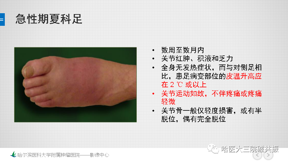 影像PPT - 【PPT】夏科足-10