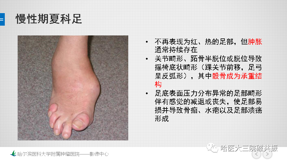影像PPT - 【PPT】夏科足-13