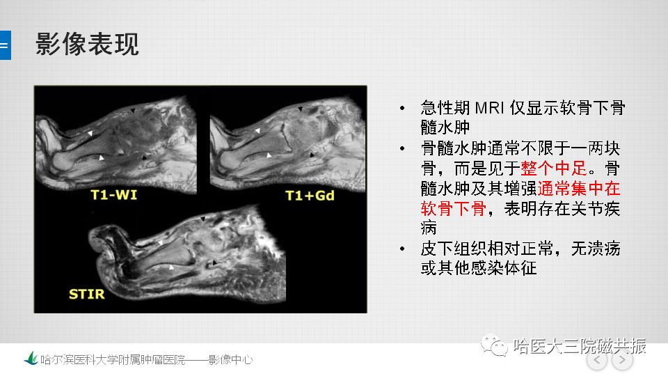 影像PPT - 【PPT】夏科足-12