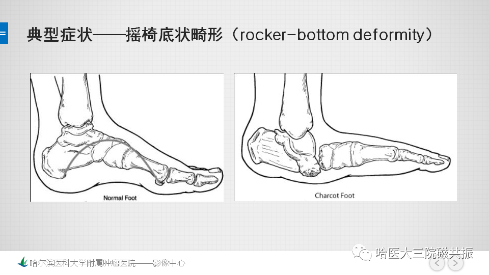 影像PPT - 【PPT】夏科足-14