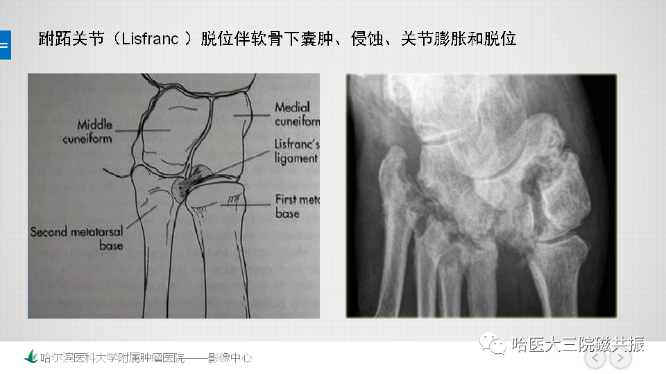 影像PPT - 【PPT】夏科足-16