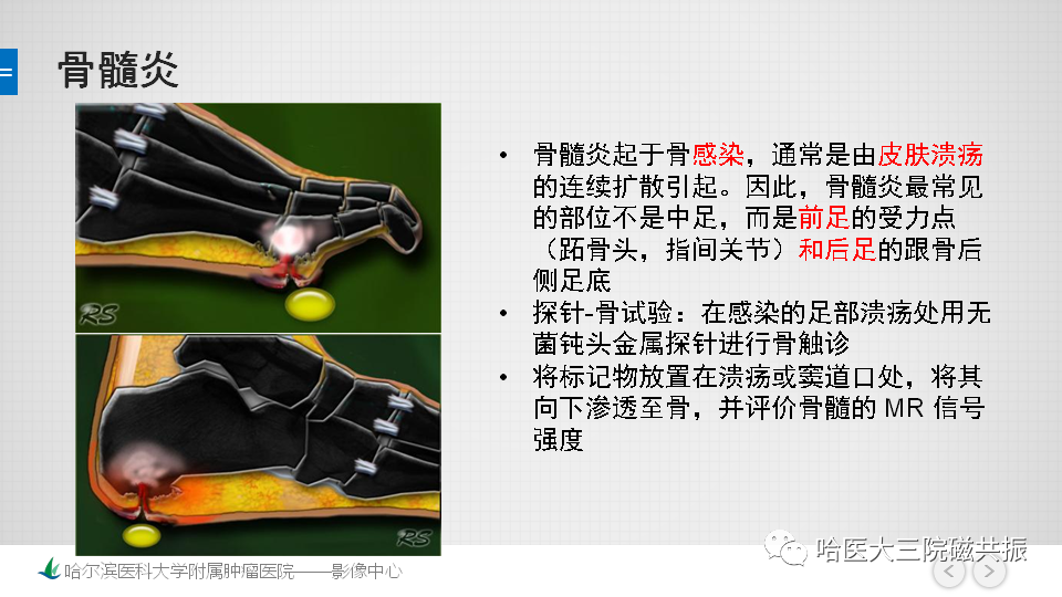 影像PPT - 【PPT】夏科足-19