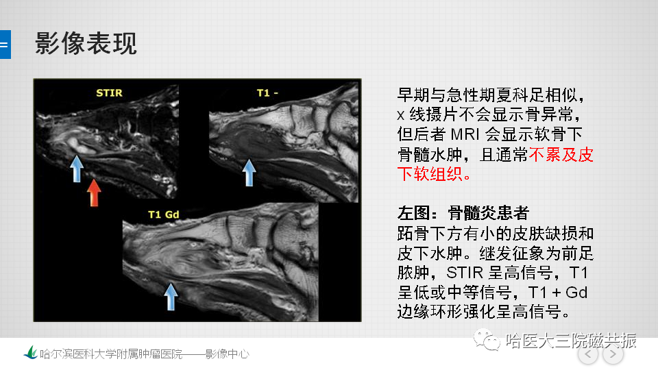 影像PPT - 【PPT】夏科足-20