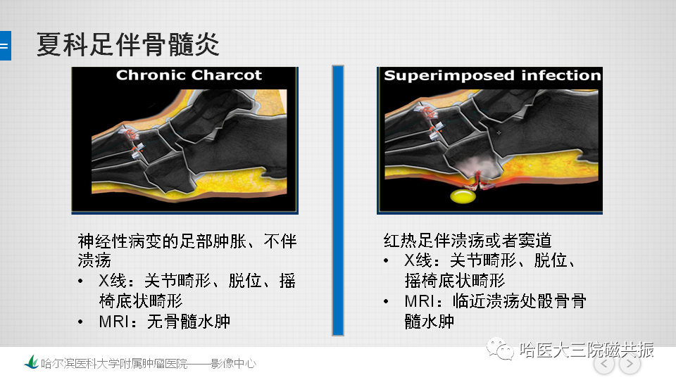 影像PPT - 【PPT】夏科足-22