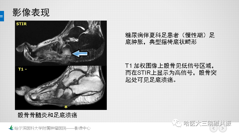 影像PPT - 【PPT】夏科足-24