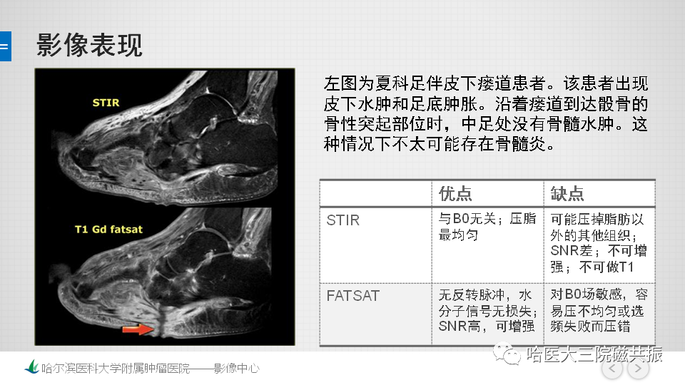 影像PPT - 【PPT】夏科足-26