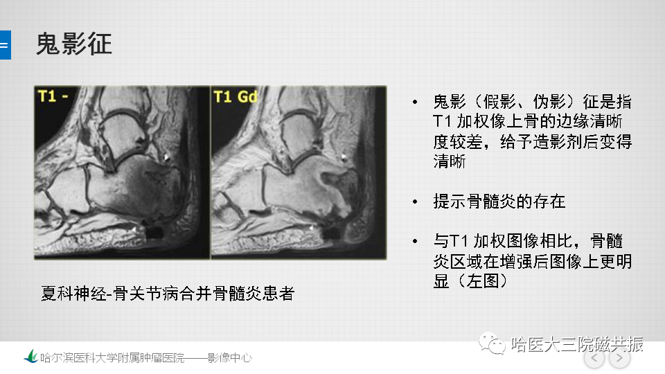 影像PPT - 【PPT】夏科足-27