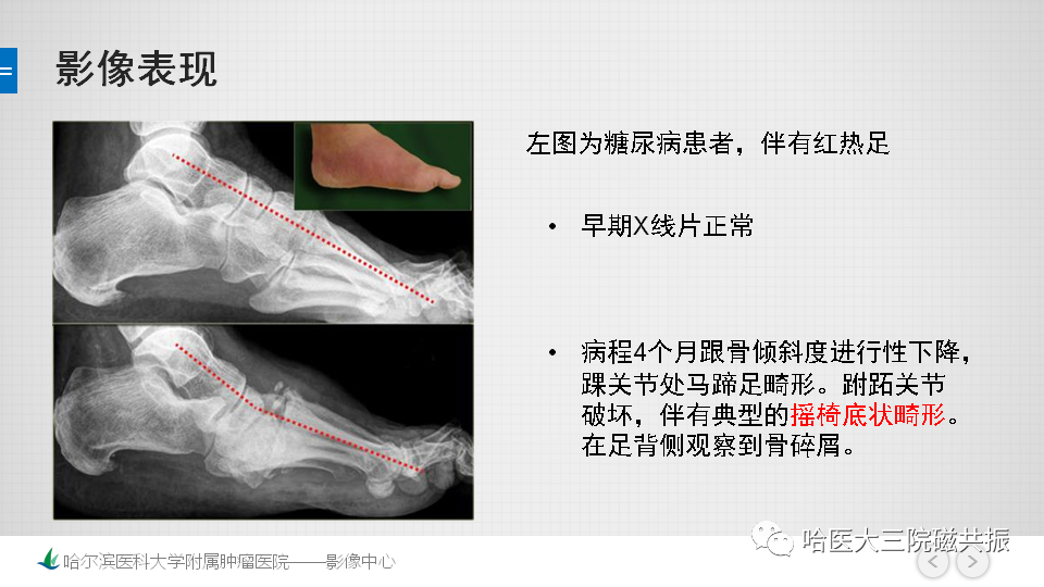 影像PPT - 【PPT】夏科足-2