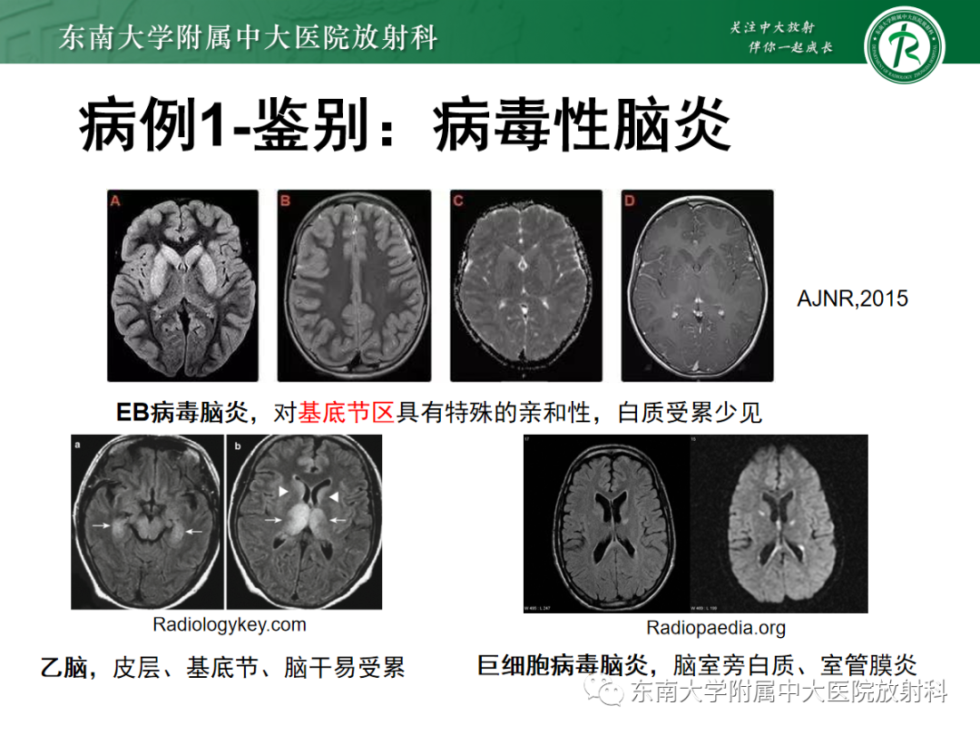影像PPT - 【PPT】皮层下U形纤维受累常见病变-14