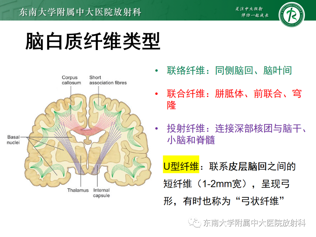 影像PPT - 【PPT】皮层下U形纤维受累常见病变-17