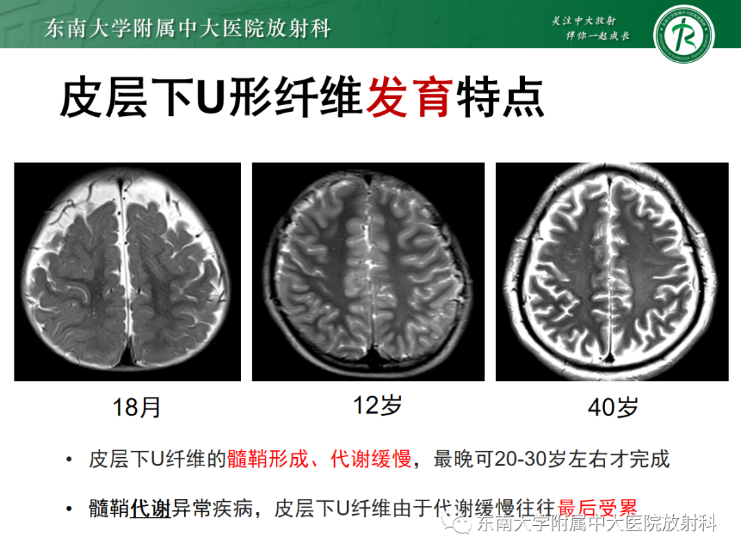 影像PPT - 【PPT】皮层下U形纤维受累常见病变-21