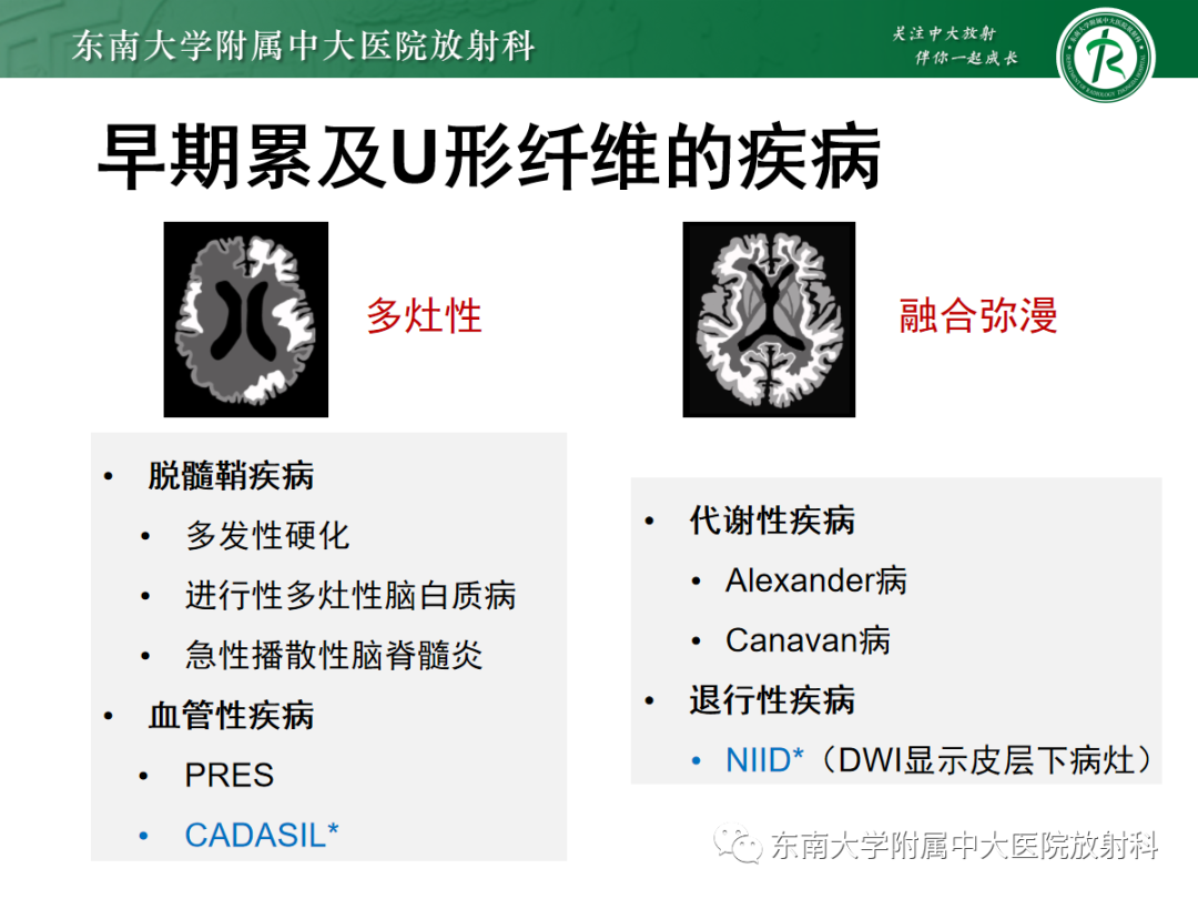 影像PPT - 【PPT】皮层下U形纤维受累常见病变-24