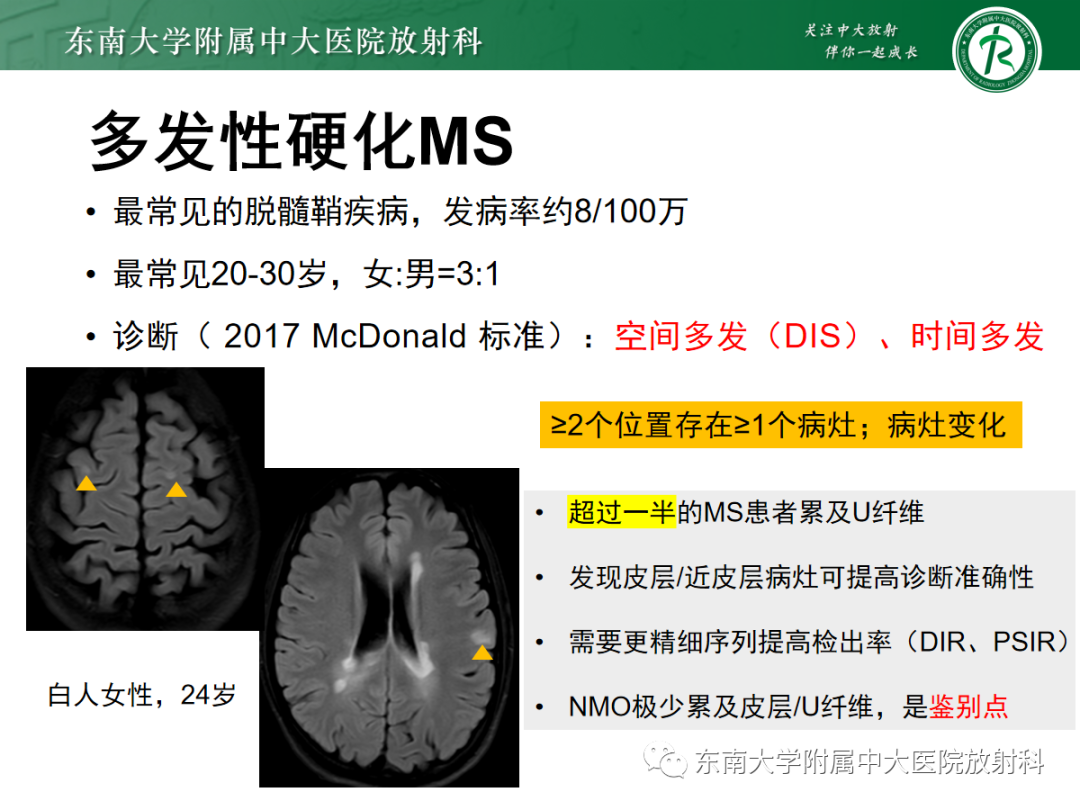影像PPT - 【PPT】皮层下U形纤维受累常见病变-25