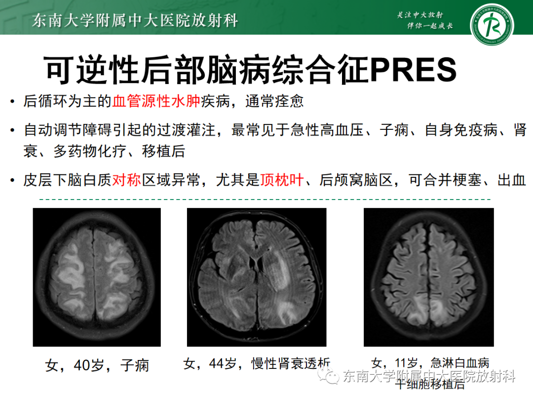 影像PPT - 【PPT】皮层下U形纤维受累常见病变-28